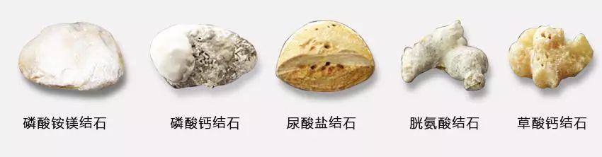 《狂飙》60岁老戏骨吴刚整容？竟是“石头”惹的祸