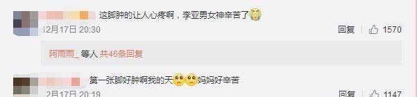 李亚男怀孕即将剖腹产，在微博晒自己孕照，网友：这脚真让人心疼