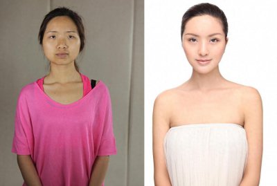 ​12张图直击女孩整容前后的对比照，最后一张让人难以想象