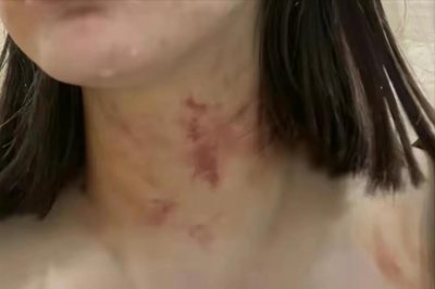 ​女子被殴打扒衣服，不服警方判定吞药自杀，曾实名举报办案民警